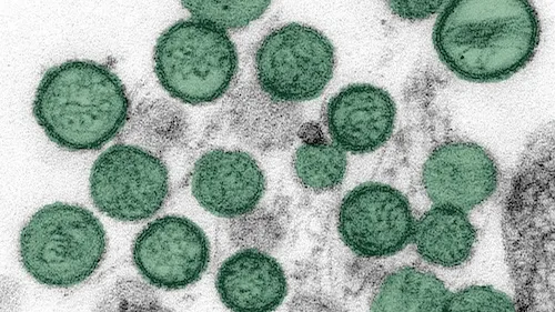 PLP engaged in preparedness activities related to the Hanta-/Andesvirus outbreak