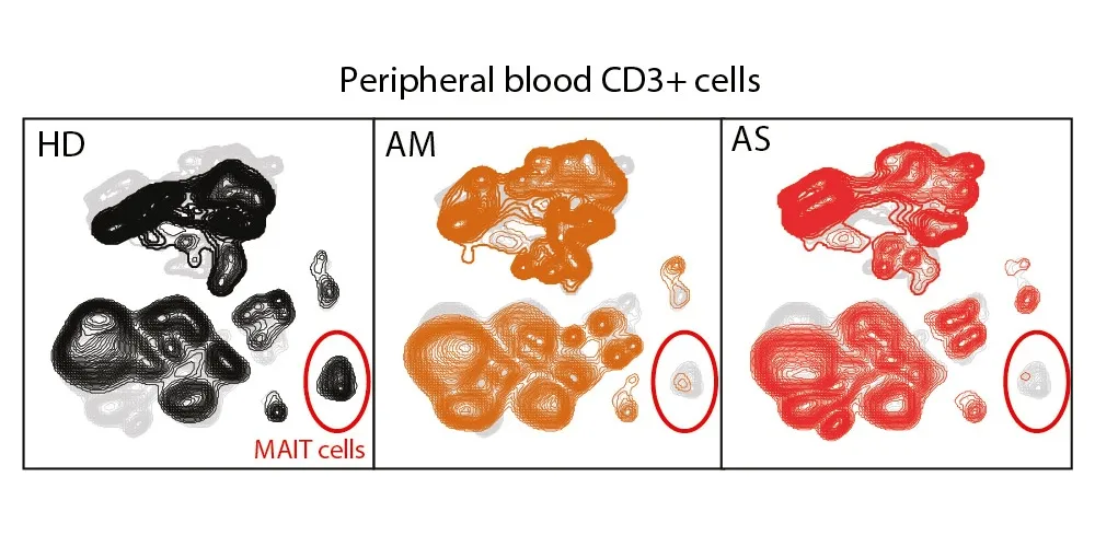 MAIT cell activation and dynamics studied in relation to COVID-19 disease severity